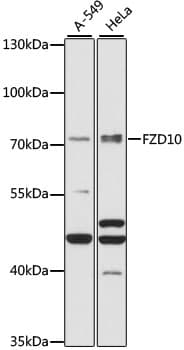 Polyclonal Rabbit anti-Human FZD10 / Frizzled 10 Antibody (WB)