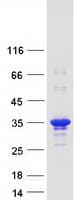Human KCTD15 Protein (Recombinant Myc-DDK (Flag))