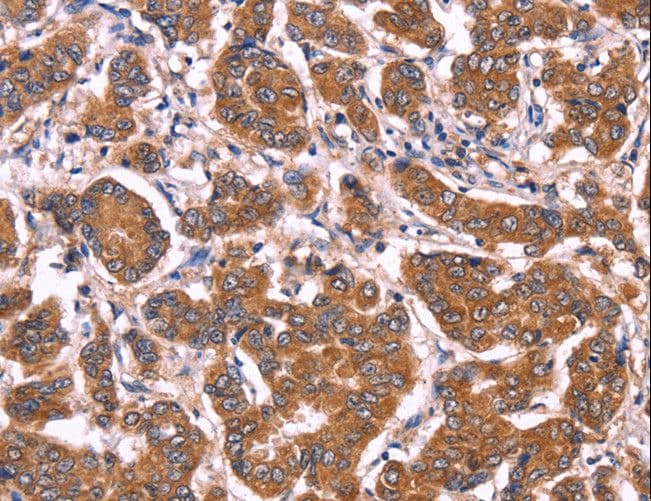 Polyclonal Rabbit anti-Human COL20A1 / Collagen XX Antibody (IHC)