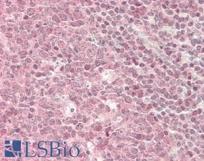 IHC-plus™ BID Antibody (aa1-195)