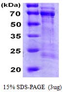 Human CDC25A Protein (Recombinant His)
