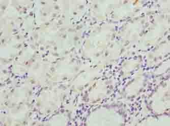 CIPC / KIAA1737 Antibody