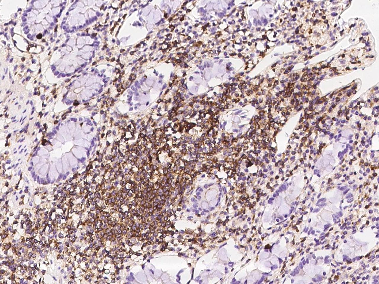 PPP1R18 Antibody
