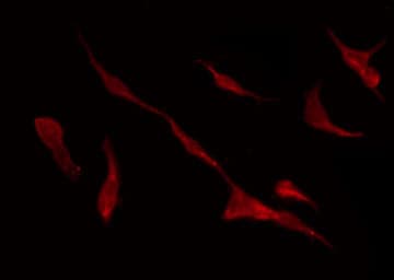 Polyclonal Rabbit anti-Human KCNQ4 Antibody (IHC, IF, WB)