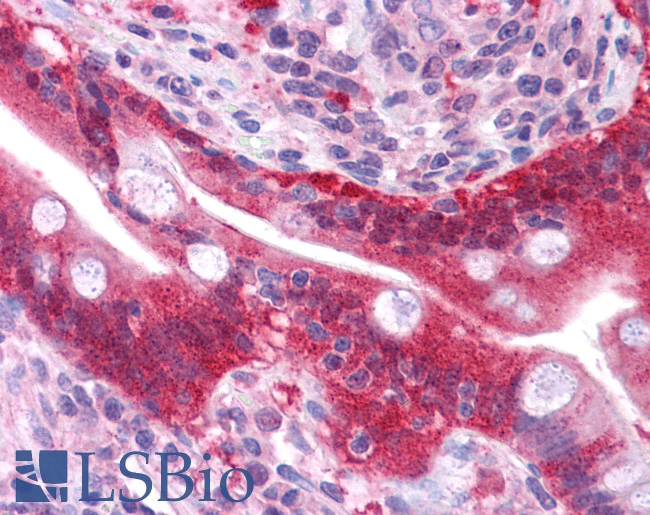 PathPlus™ LGALS3 / Galectin 3 Antibody (aa38-87)