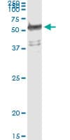 WARS Antibody (clone 3A12)