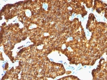 CHGA / Chromogranin A Antibody (clone SPM553)