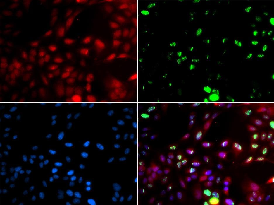 POLK / DNA Polymerase Kappa Antibody