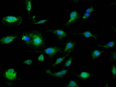Polyclonal Rabbit anti-Human SLC25A24 / APC1 Antibody (IHC, IF, WB)