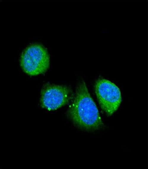 ASPN / Asporin Antibody (aa242-269)