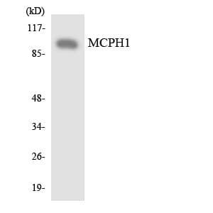 Polyclonal Rabbit anti-Human MCPH1 Antibody (aa82-131, IHC, WB)