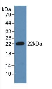 ADM / Adrenomedullin Antibody (aa24-171)
