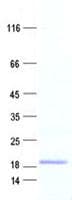Human CSTL1 / Cystatin-Like 1 Protein (Recombinant His, N-Terminal)