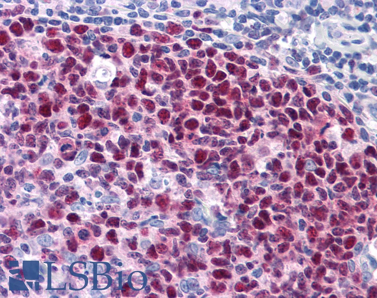 IHC-plus™ Polyclonal Rabbit anti-Human TAB2 Antibody (IHC)