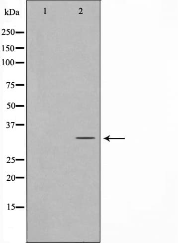 NEUROD1 Antibody