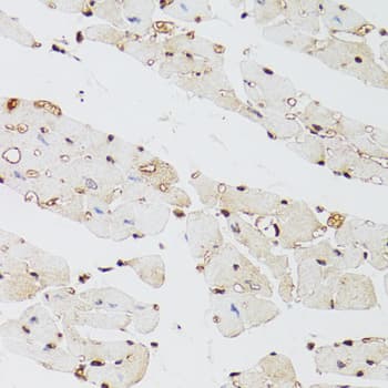 KDM4A / JHDM3A / JMJD2A Antibody