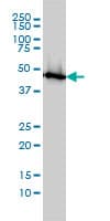 PathPlus™ ENO1 / Alpha Enolase Antibody (clone 8G8)