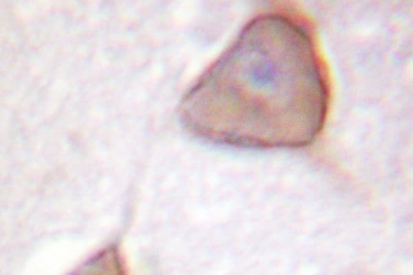 ADD1 / Adducin Alpha Antibody (Lys720)