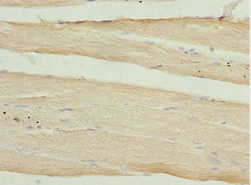CALCOCO2 Antibody