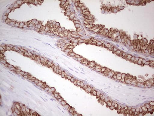 ABCB1 / MDR1 / P Glycoprotein Antibody (aa995-1280, clone OTI1A7, Carrier-free)