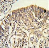 PLTP Antibody (aa451-479)