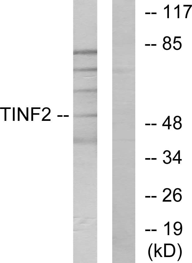 Polyclonal Rabbit anti-Human TINF2 Antibody (aa71-120, WB)