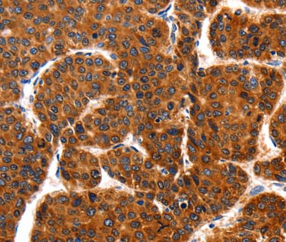 TRAP1 / HSP75 Antibody