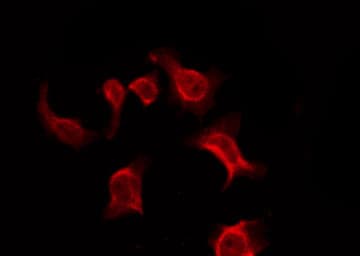 OR9Q1 Antibody