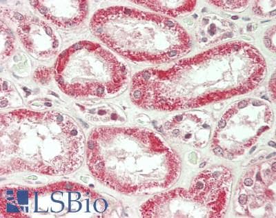 IHC-plus™ Neurofibromin / NF1 Antibody (aa2760-C-term)