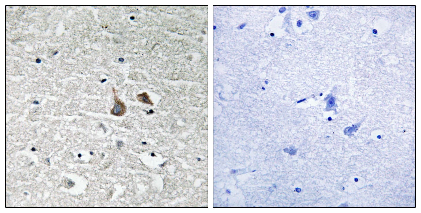 IRAK1 / IRAK Antibody (phospho-Ser376)