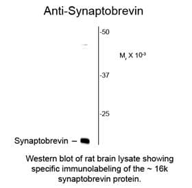 Monoclonal Mouse Synaptobrevin / VAMP Antibody (clone SP10, IHC, WB)