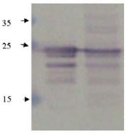 CTF1 / Cardiotrophin-1 Antibody (Preservative Free)