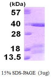Human TICAM2 / TRAM Protein (Recombinant His)