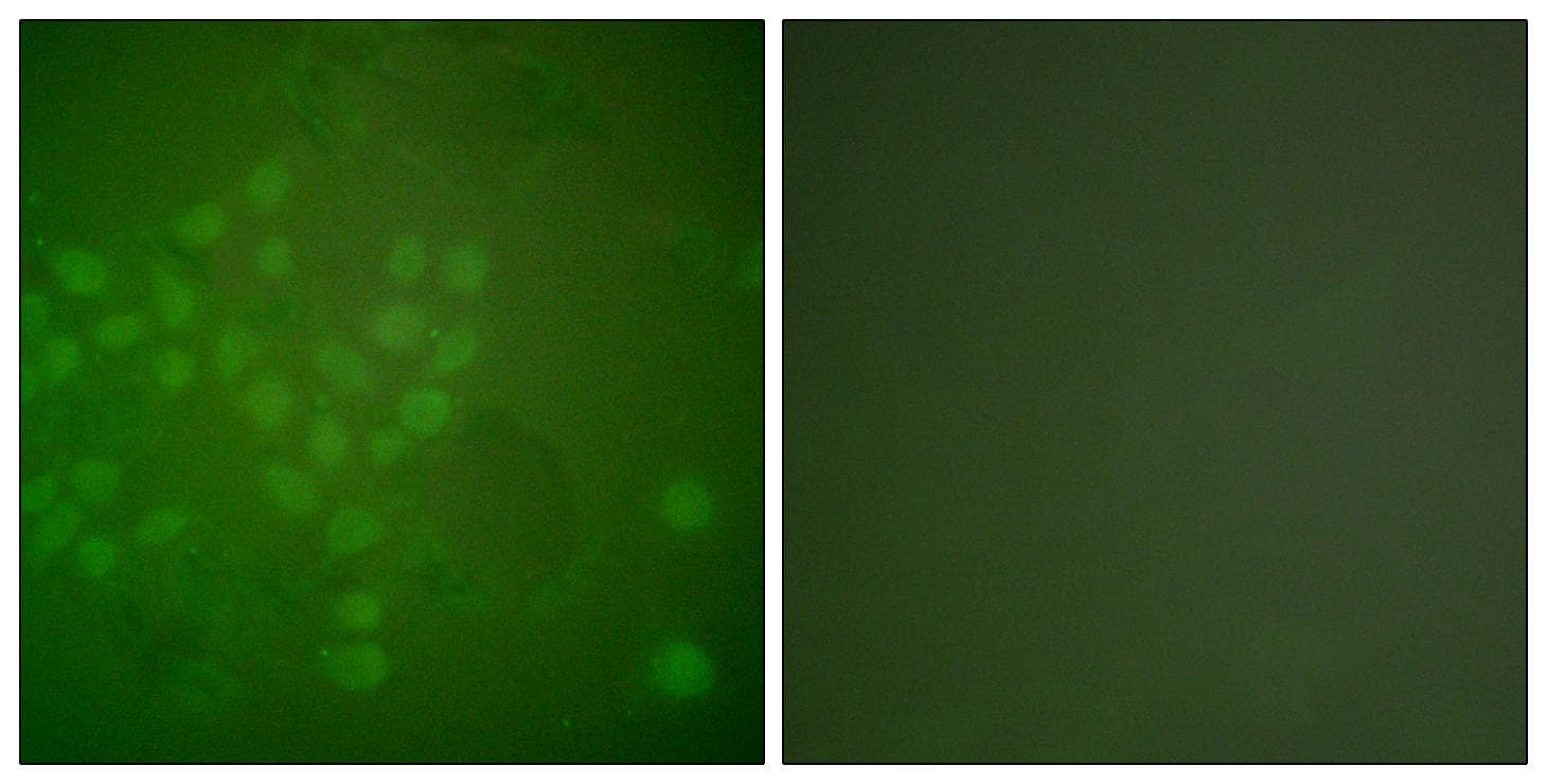 Polyclonal Rabbit anti-Human RAD17 Antibody (p645, IHC, IF, WB)