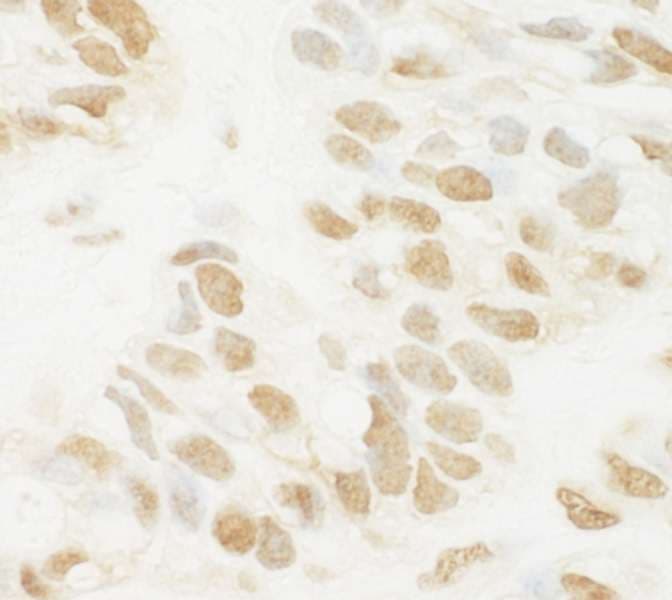 Polyclonal Rabbit anti-Human MED13L Antibody (aa550-600, IHC, WB)
