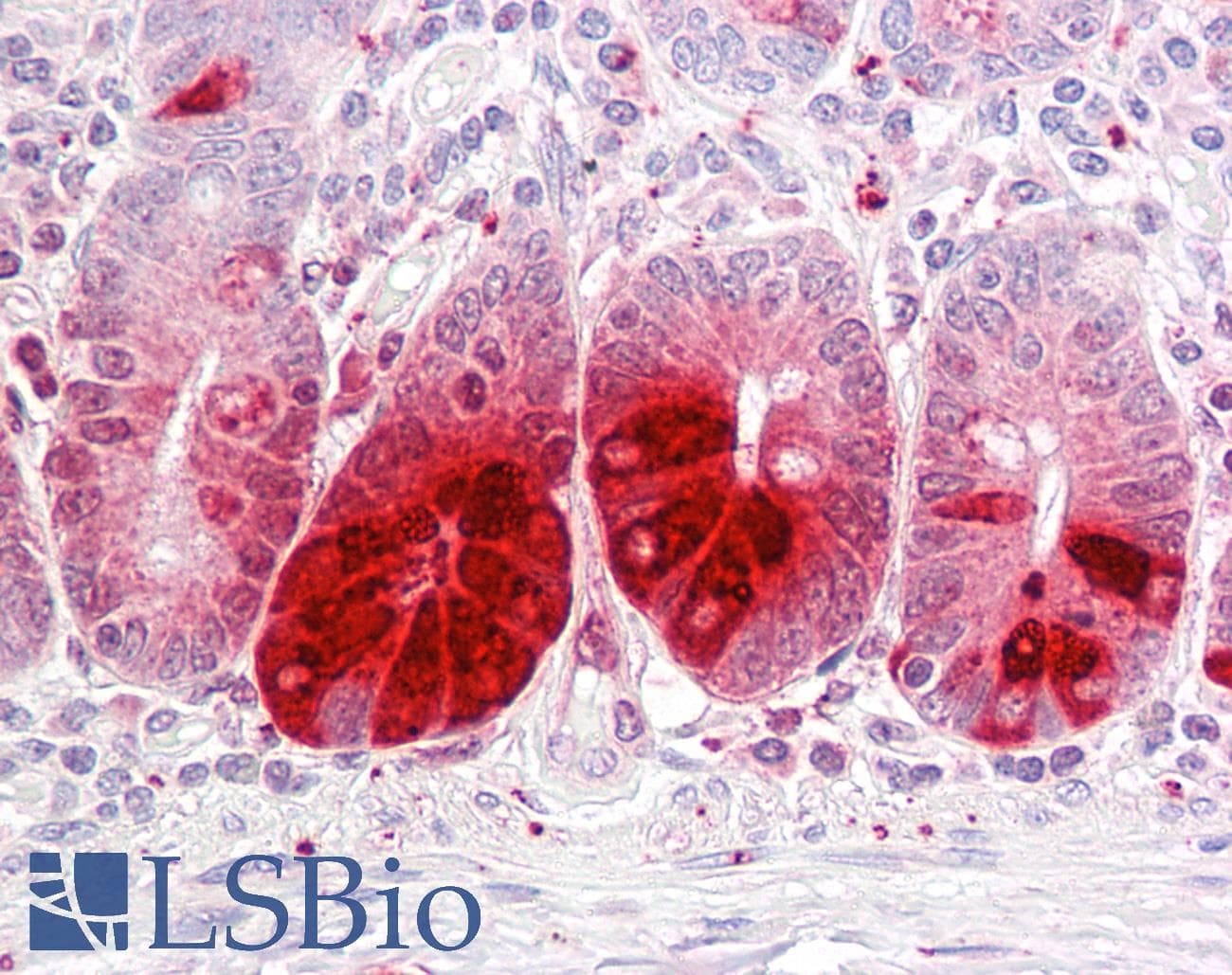 IHC-plus™ REG3A Antibody (aa1-50)