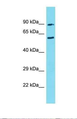 Polyclonal Rabbit anti-Human CIRH1A Antibody (aa237-286, WB)