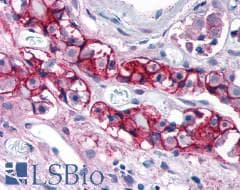 PathPlus™ CELSR2 Antibody (N-Terminus)
