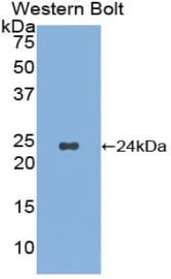 NOG / Noggin Antibody (aa27-223, PE)