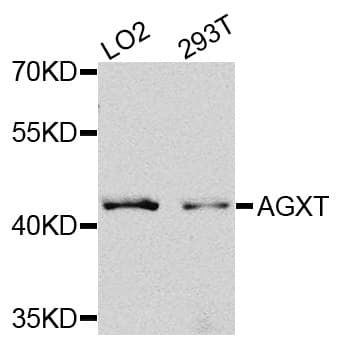 AGXT / SPT Antibody