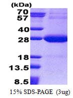 Human NDUFV2 Protein (Recombinant His)