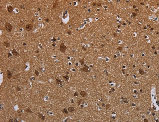 MYCN / N-myc Antibody