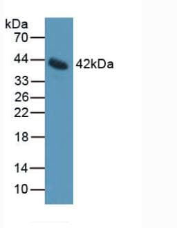 IL11RA Antibody (aa194-329)