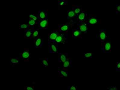 HIST1H1C Antibody