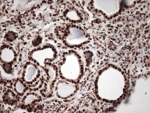 Monoclonal Mouse anti-Human TRIM28 / KAP1 Antibody (clone OTI8B12, IHC, IF, WB)