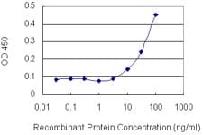 Monoclonal Mouse anti-Human PLCB2 Antibody (clone 1B3)