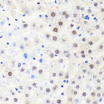 POLR2B / RPB2 Antibody
