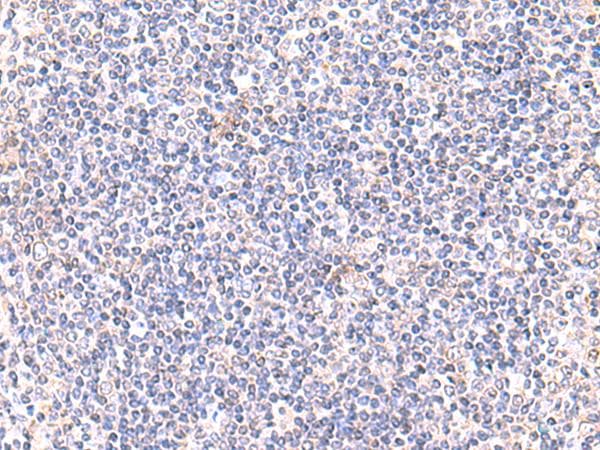 Polyclonal Rabbit anti-Human IFT57 / HIPPI Antibody (IHC)