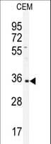 Rabbit Anti-Human IgA1 Secondary Antibody