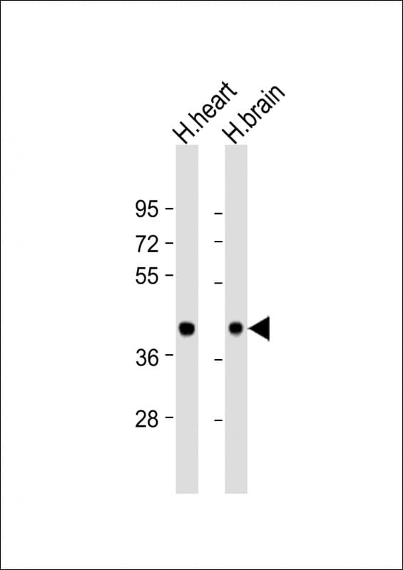 BRCC3 / BRCC36 Antibody (aa36-70)